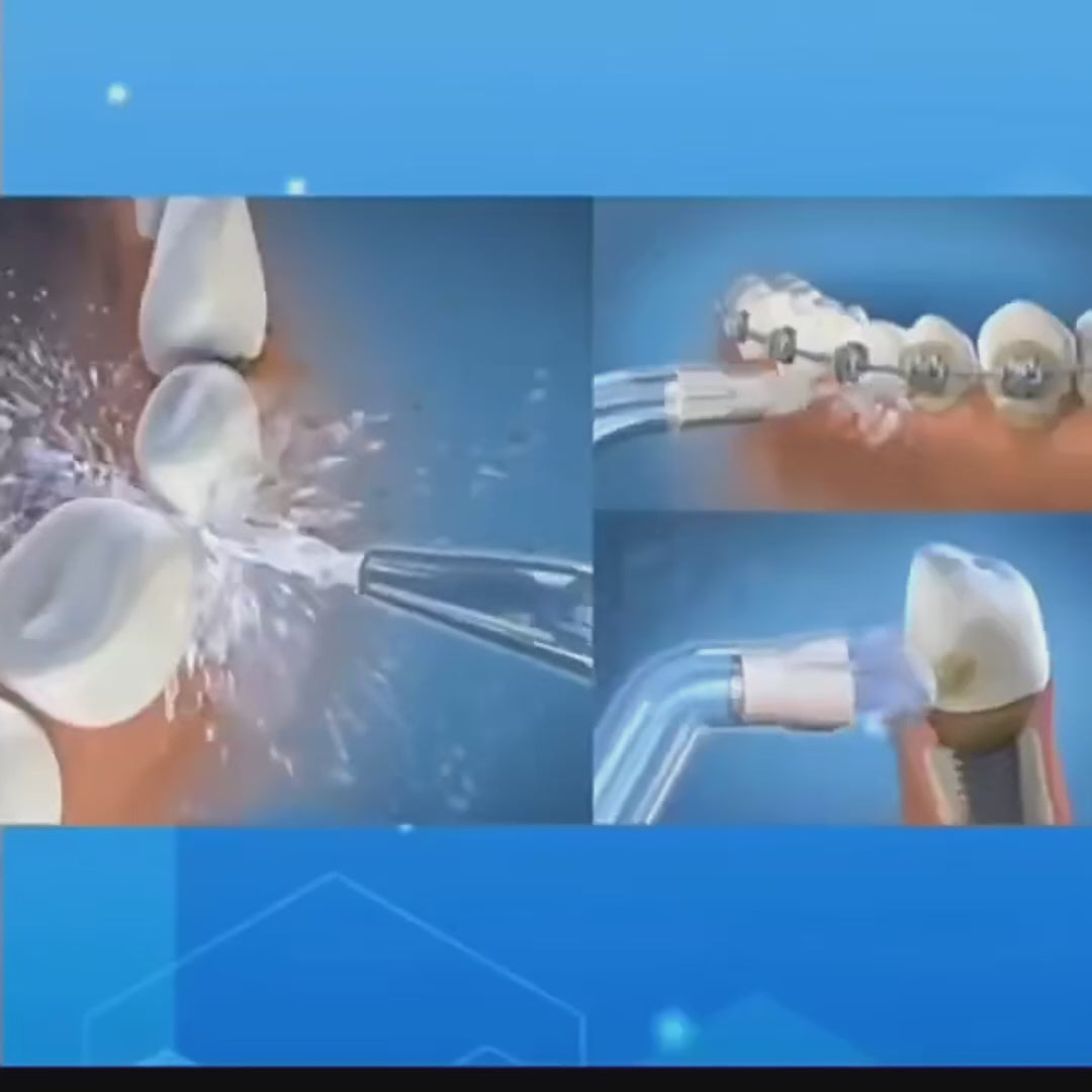 וידאו נטען: סרטון הדמייה.mp4__PID:3fcaf0fd-e9c6-43eb-b33e-a7b839a8331c
